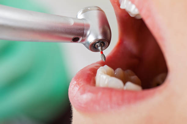 Best Emergency Gum Pain Relief  in Winchester, TN